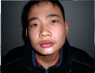 患者心声：何时才能打败白癜风 开启我的新人生呢